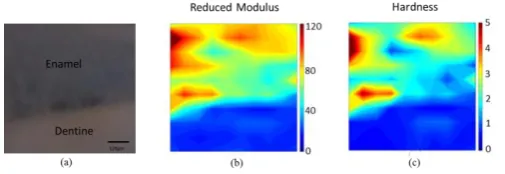 Fig.3 Micro-focus SAXS mapping of dental slice. (a) human dental slice of region of interest (ROI); (b) mean thickness and (c) degree of  alignment mapping obtained by SAXS data analysis [6]