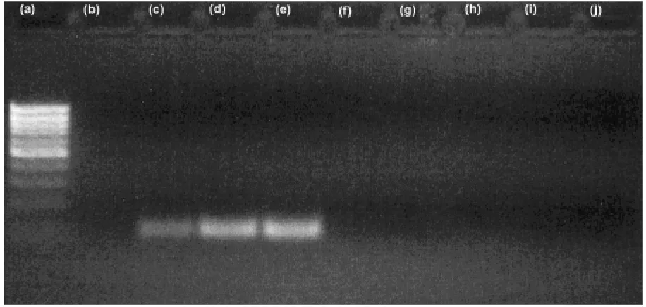 Fig. 4. Detection of CaMV promotor using VOLLENHOFER et al. (1999) primer pairs: left to right DNA ladder, non-modifiedsoybeans (IMMR standard), GM soybeans (0.1% IMMR standard), GM soybeans (0.5% IMMR standard), GM soyabeans (2.0%IMMR standard), non-modified soya leaf, sugar-beat leaf, wheat leaf, corn flour, corn leaf, template-free control
