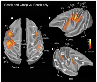 Figure    1.4.    Monkey    fMRI.    Neural    correlates    of    grasping:    Activation    for    the    univariate    contrast    [reach-­‐and-­‐grasp    vs    reach-­‐only]   activation   map   is   overlaid   on   a   3D   repr