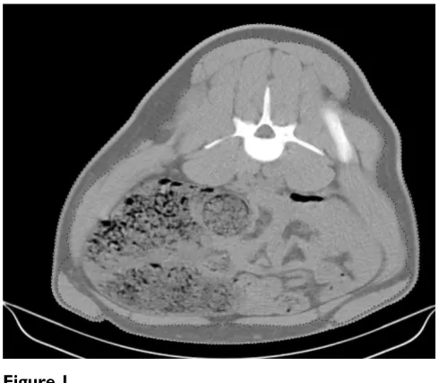 Figure 1Computer tomography imageComputer tomography image. Transverse CT image showing the automatically determined boundaries