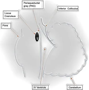 Figure 3. Diagram showing approximate location of locus coeruleus, a highly pigmented structure in brainstem
