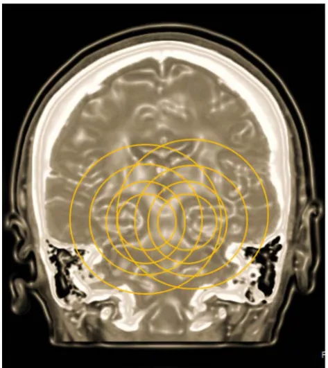 Figure 7. Growing spheres of energy coming from the substantia nigra, in the drawing are represented as circles of orange color, ranging from the Center to the periphery, following the laws of simple diffusion