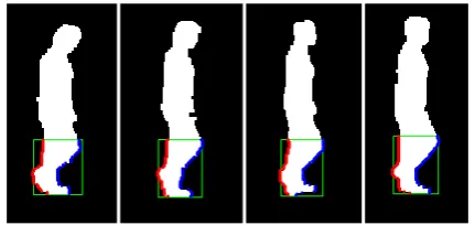 Fig 6. Detected image when two legs are overlapped 
