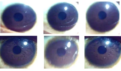 Fig 3a CASIA iris images.(Source: 