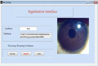 Table 2 showed the evaluation results on 756 eye images of 