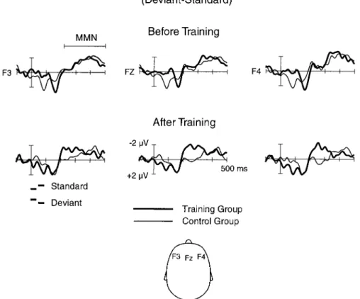 Fig. 3. Electrophysiological responses of dyslexic children in the training and control groups (11 children in each group) at the frontal scalp to tone-order reversals (the response elicited by the standard pair subtracted from that elicited by the deviant