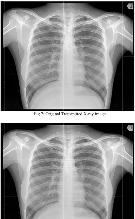 Fig 7: Original TTransmitted X-rayy image. 