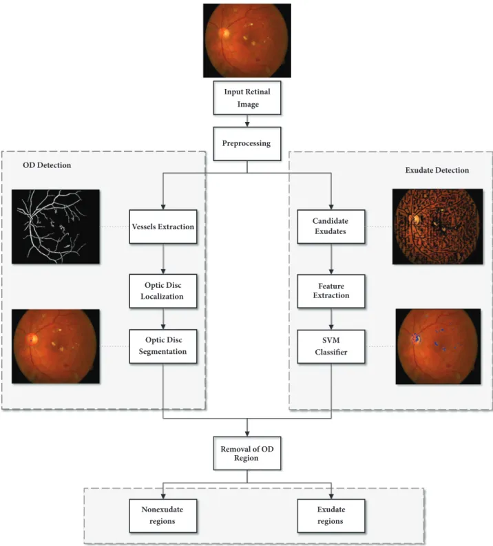 Figure 2: Flow chart of our proposed algorithm for automatic detection of HE.