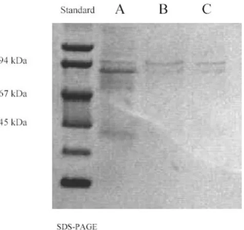 Figure 6SPS-PAGE of faecesSPS-PAGE of faeces. A: before purification; B: after purifica-tion in an affinity chromatography column immobilised by 