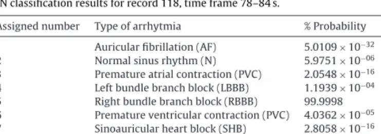 Table 5 shows a numerical summary of the wave identiﬁcation results, and the resulting features needed to feed the PNN.