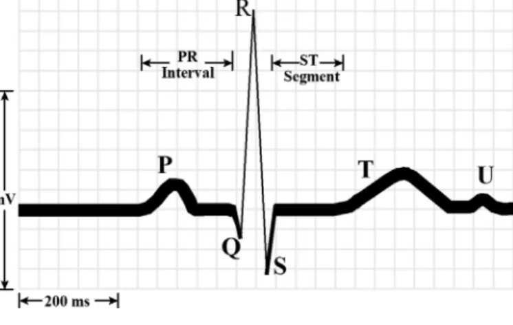 Fig. 1. Normal ECG pattern.