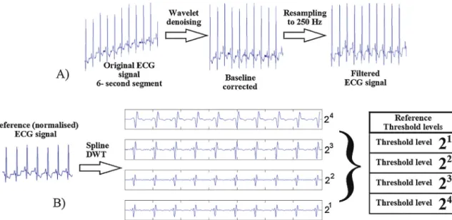 Fig. 4. Preprocessing the ECG signal includes performing (A) signal denoising and resampling operations to prepare the ECG signal for feature extraction and (B) obtaining the threshold reference values in the four scales.