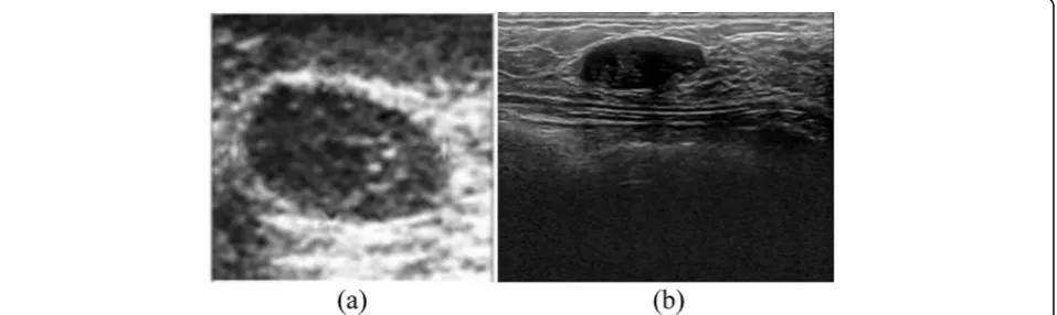 Fig. 1 a Example of a cropped image from Dataset A and b Example of original image from Dataset B
