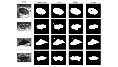 Fig. 6 Examples of contours obtained by the three CNN architectures