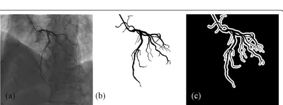 Fig. 1 An example of masks that are utilized for quantitatively validation of the proposed method