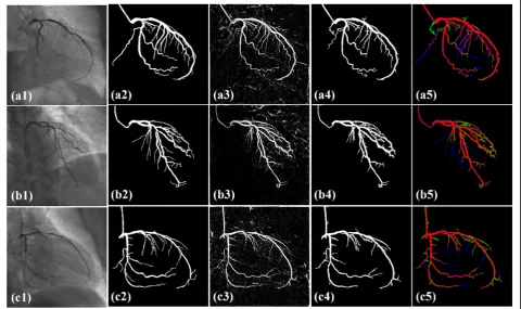 Fig. 6proposed method. Angiograms in the first column arerandomly selected from image sequences