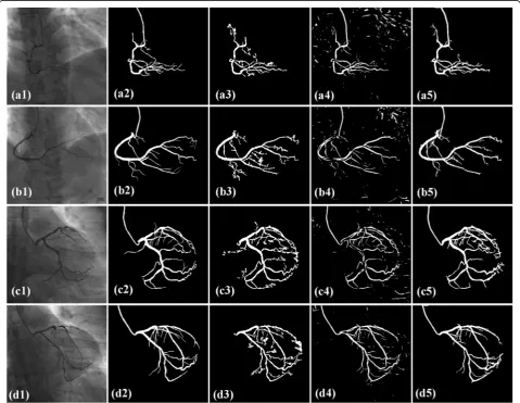 Figure 7cluding LevelSet, FC-CRF and the proposed model. Inthe first column, two right and two left coronary arteryangiograms are randomly selected from the image se-quences