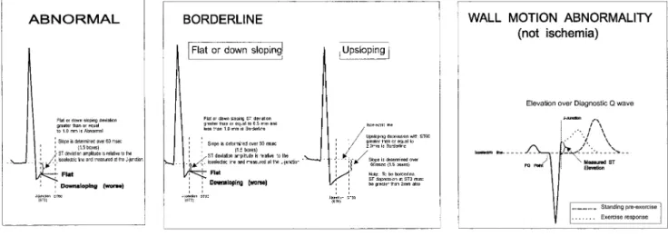 Figure 5. ST deviation assessment.