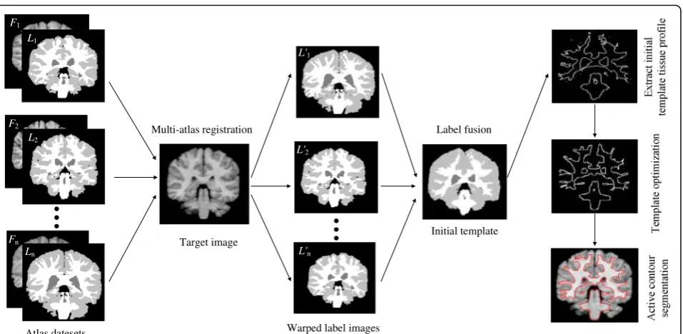 Fig. 1 Schematic diagram of multi-atlas active contour segmentation method using template optimization algorithm