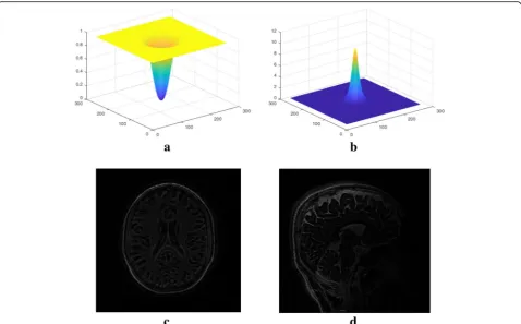 Fig. 2 a High-pass filter and b its inverse filter (c = 24 and w = 8); c simulated axial brain image after filtering, and d sagittal brain image after filtering