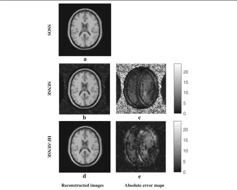 Fig. 4 Results of the simulated axial brain dataset.image reconstructed with SSOS, Tikhonov regularized SENSE ( c = 24 and w = 8 were used in the high-pass filter