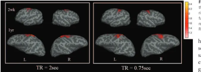 Fig 5. A comparison of 2 different TRs for obtaining rfc atthe sensorimotor area is shown