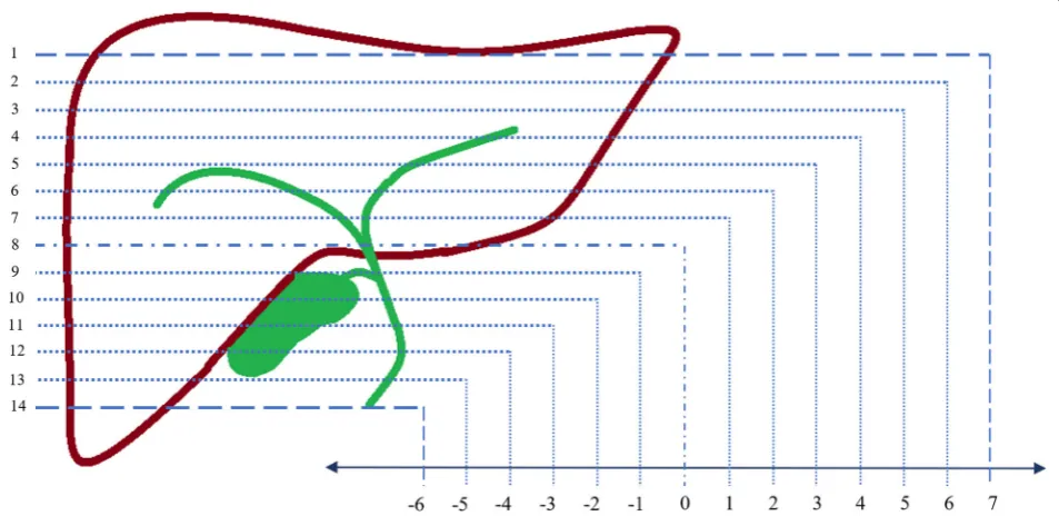 Fig. 1 Screenshots illustrating examples of the different region of interest (ROI) placements for the freehand whole liver, the elliptical right lobeand the elliptical left lobe
