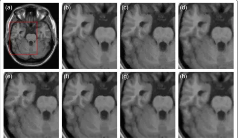 Table 1traditional collateral filter and our accelerated version onthe same 217 × 181 brain MR images
