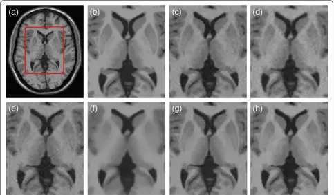 Fig. 5 Comparison of visual restoration results on slice 26 with 7% noise in the 3 mm MS dataset
