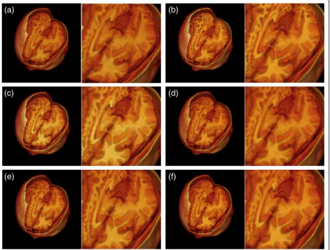 Figure 6normal image volume with 9% noise level and 40% in-tensity non-uniformity in 3D visualization