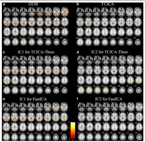 Fig. 6 Group spatial activation of the fMRI data. (da) The activated regions detected by GLM