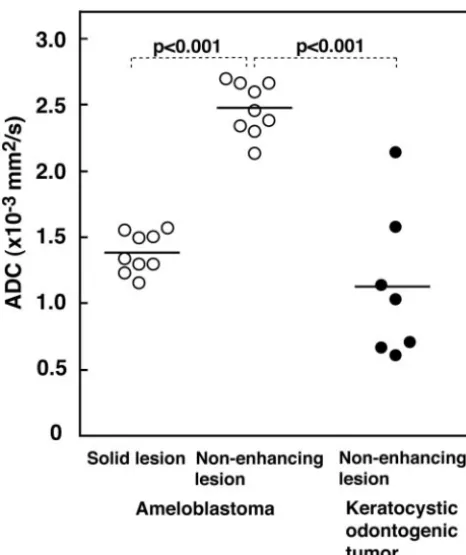Fig 4. Scatterplot shows ADCs of nonenhancing and solid lesions of ameloblastomas andMann-Whitneykeratocystic odontogenic tumors