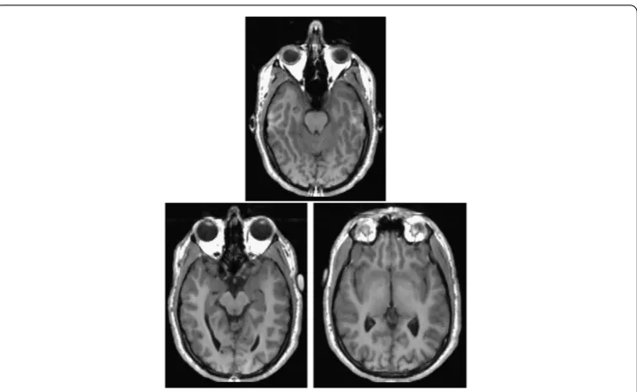 Figure 1 Template (top), reference (bottom left) and integrated (bottom right) images.