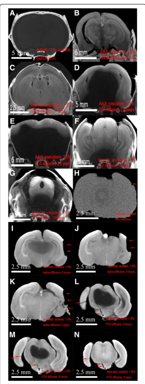 Figure 3c and d show high-definition progressive views of