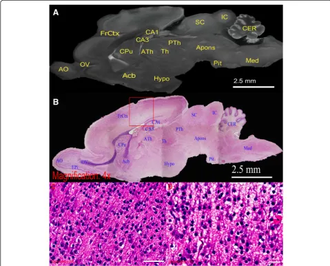 Fig. 4 High-powered demonstration of rat brain by ex vivo micro-CT scan. Direct comparison between the sagittal section of rat brain in (a),micro-CT slice, and (b), H&E stained 4× light micrograph