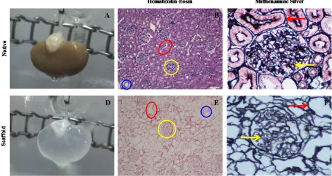 Figure 2. Histological analysis of renal scaffold. ((B), (E)) H&E staining of native (B) versus decellularized kidney (E)