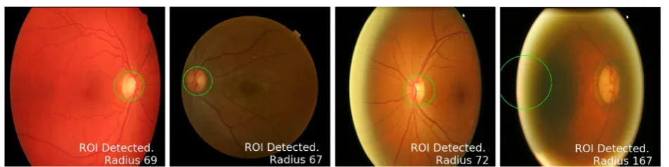 Fig. 4 Binary images showing misleading bright spots. RGB image in a is rescaled to fit in square window