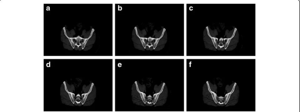 Fig. 4 The mutual information value of candidate key frames for Patient 1