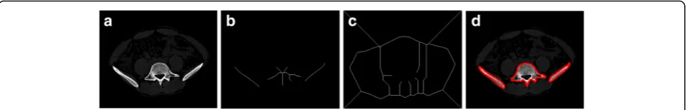 Fig. 10 Example results of Patient 1 obtained by the watershed algorithm based on skeleton markers