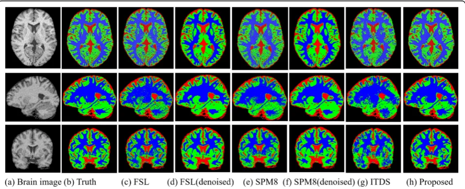Fig. 2 Segmentation results using different methods for the brain image with 9% noise and INU level of 40% from the BrainWeb18 dataset
