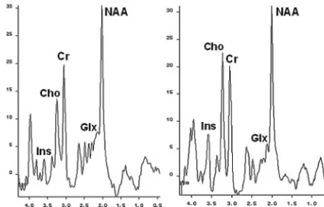 Fig 2. 2.1–2.5 ppm), creatine/phosphocreatine (Cr, 3.02 ppm), choline-containing compounds (Cho,3.2 ppm), and myo-inositol (Ins, 3.55 ppm)