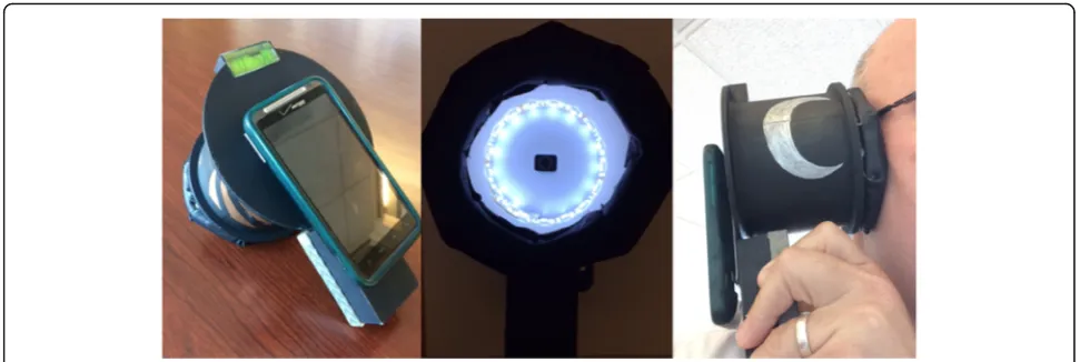 Fig. 2 This figure shows the image stabilization device (the Donut). The leftmost image shows the back of the Donut, where the phone isattached