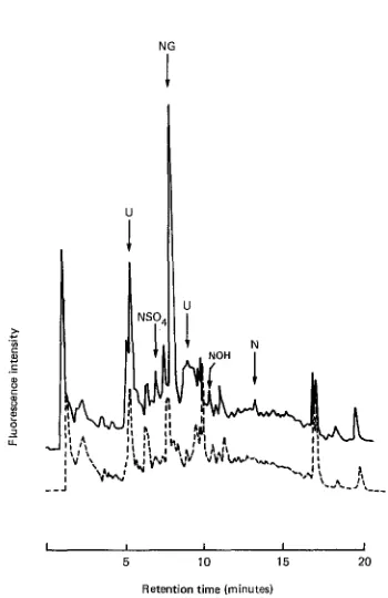Fig. 7. HPLC profiles of naphthalene and its metabolifes in the bile of rainbow trout