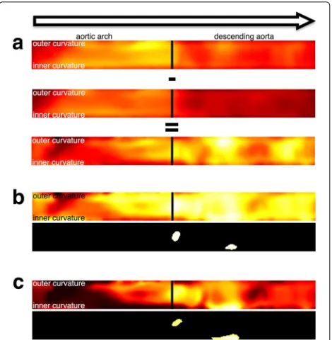 Fig. 6 Panel a shows the average maps of two test groups as well asthe mean difference map derived from those average images