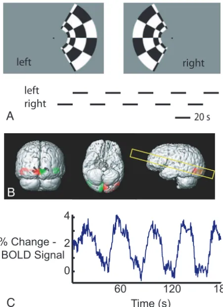 Fig 1. Selection of regions of interest.corresponding to activation in left and right visual cortices