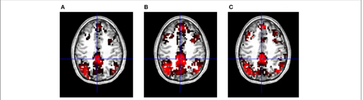 FIGURE 5 | T-maps of significant connectivity from the first measurements with GSReg, thresholded at FDR corrected p = 0.001