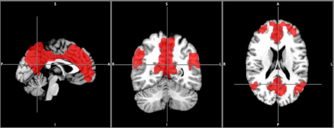 Figure S2 Sub-networks of visual system. Clustering results from an additional iteration with 8-cluster split of the visual network (Fig