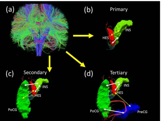 Figure 2.1: Three types of structural paths defined using diffusion tractography (a): whole-brain fiber connection network construction by Diffusion Tensor  Imag-ing data; (b): Heschl gyrus (HES) and Insula (INS) are directly connected with each other thro