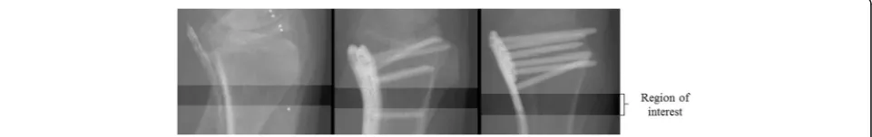 Fig. 1 Each volar distal radius plate was instrumented in one cadaveric forearm by means of a standard volar approach