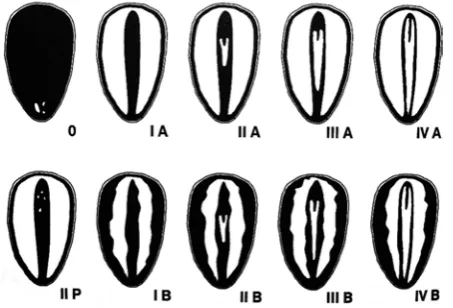 Fig. 1. Diagram of development of the embryo and endosperm according to Swedish classification (Załęski et al